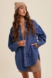 Heart Detail Oversized Denim Shirt: Light Denim