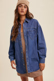 Heart Detail Oversized Denim Shirt: Light Denim